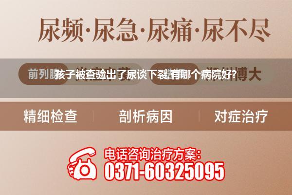 孩子被查验出了尿谈下裂,有哪个病院好?